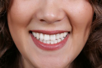 Buckley teeth whitening professionals in WA near 98391
